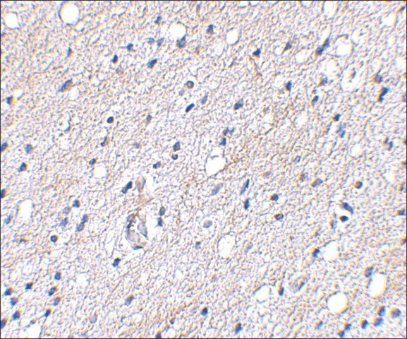 Anti-BAP3 antibody produced in rabbit