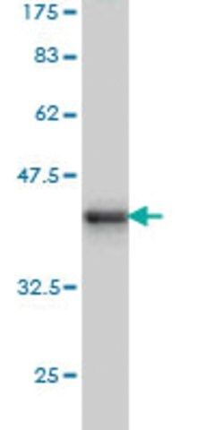 ANTI-BARX1 antibody produced in mouse