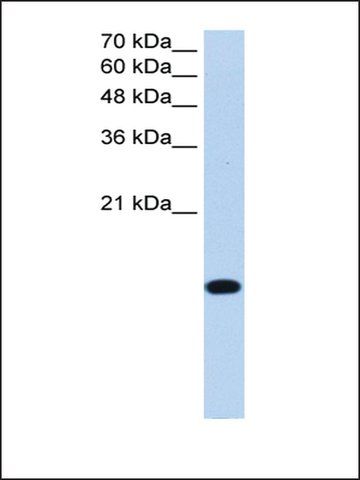 Anti-BATF2 antibody produced in rabbit