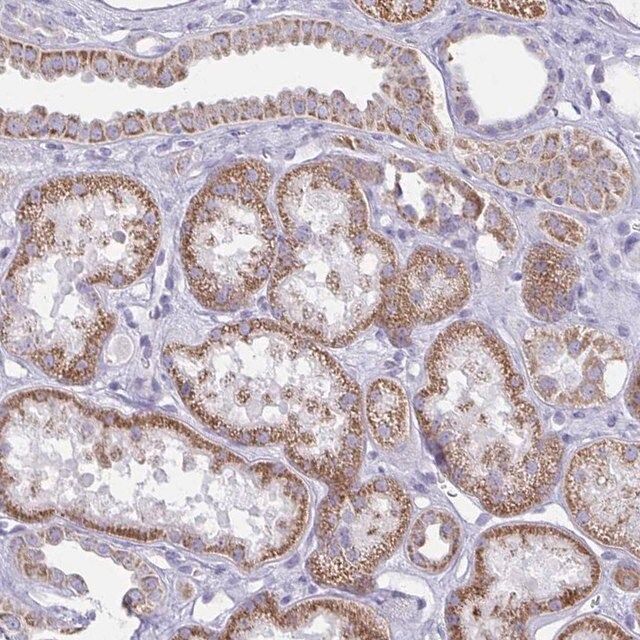 Anti-BBS1 antibody produced in rabbit