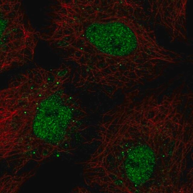 Anti-BARX1 antibody produced in rabbit