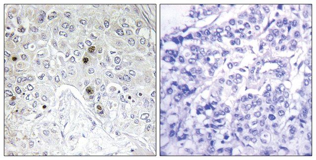 Anti-BATF antibody produced in rabbit