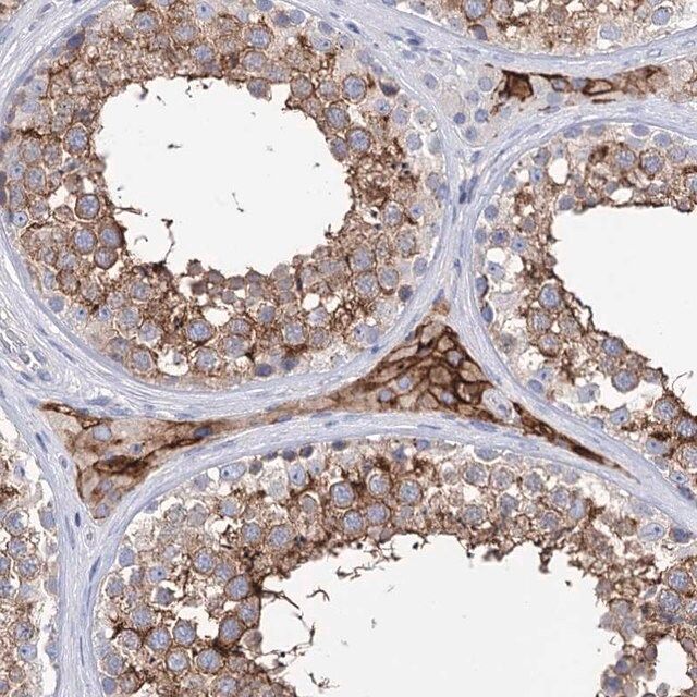 Anti-BBS4 antibody produced in rabbit