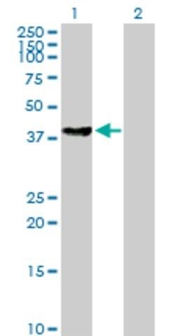 Anti-BBS5 antibody produced in mouse