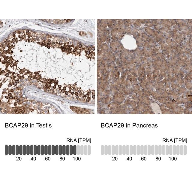 Anti-BCAP29 antibody produced in rabbit