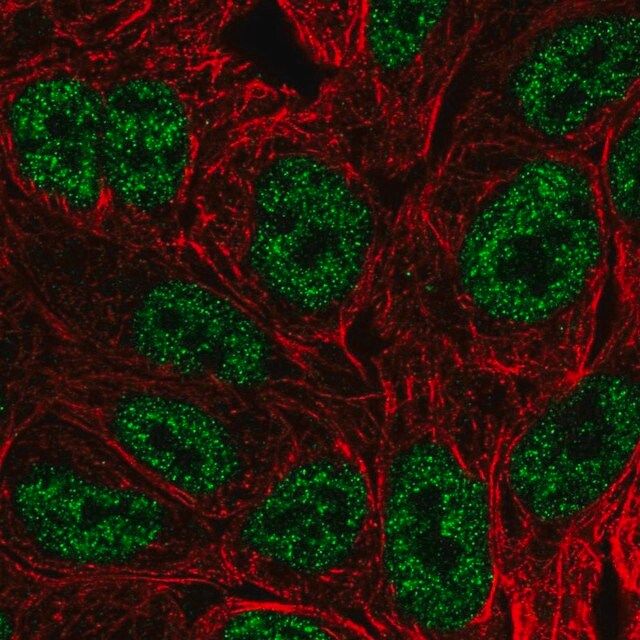 Anti-BATF antibody produced in rabbit