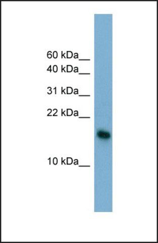 Anti-BATF3, (N-terminal) antibody produced in rabbit