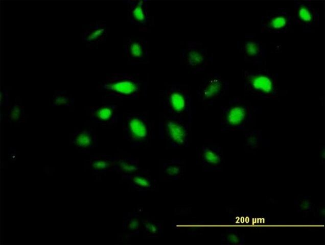 Anti-BCCIP antibody produced in mouse