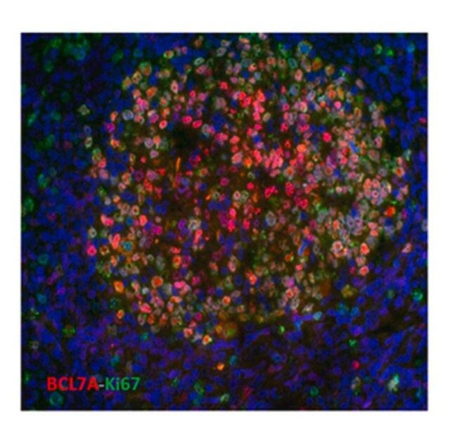 Anti-BCL7A Antibody, clone 15C