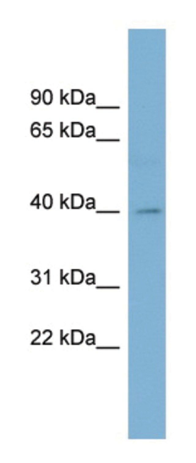 Anti-BCAT1 (N-terminal) antibody produced in rabbit