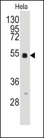 Anti-BBS4 (center) antibody produced in rabbit