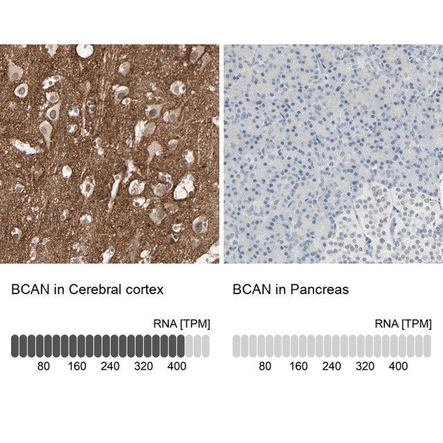 Anti-BCAN antibody produced in rabbit