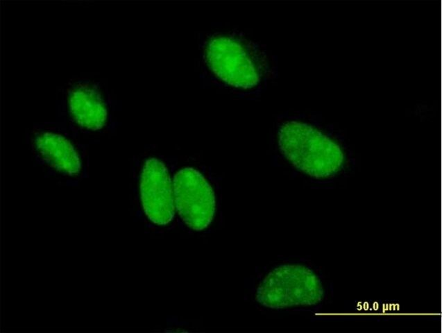 Anti-BCCIP antibody produced in mouse