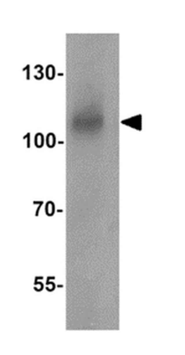 Anti-BCAR3 Antibody