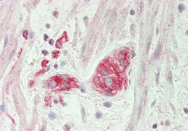 Anti-BCKDK antibody produced in rabbit