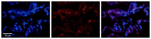 Anti-BCKDHA, (N-terminal) antibody produced in rabbit