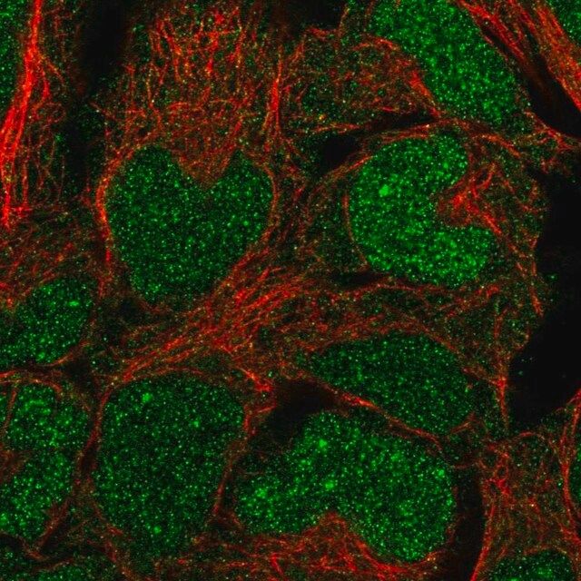 Anti-BCCIP antibody produced in rabbit