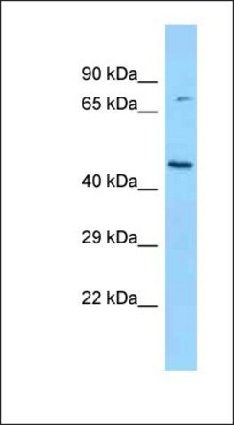 Anti-BCKDK antibody produced in rabbit