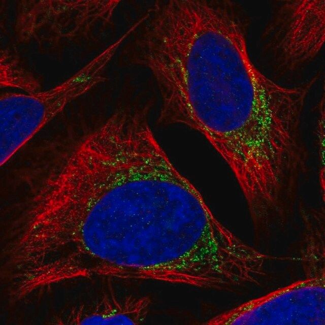 Anti-BCKDK antibody produced in rabbit