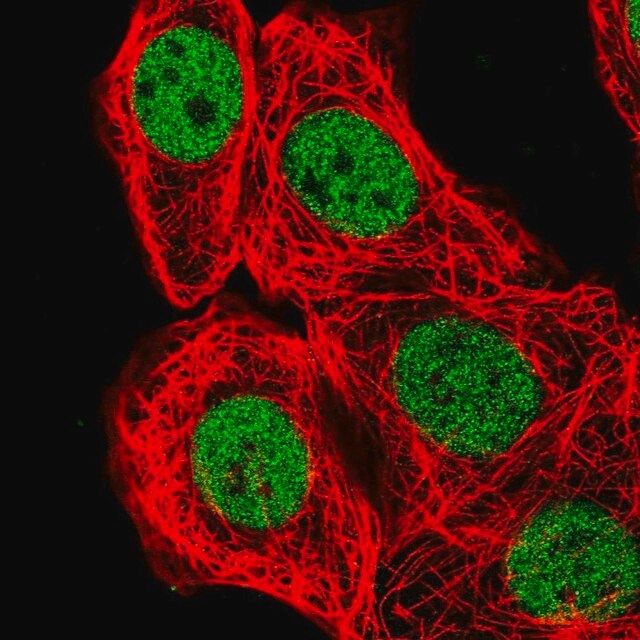 Anti-BCL7B antibody produced in rabbit