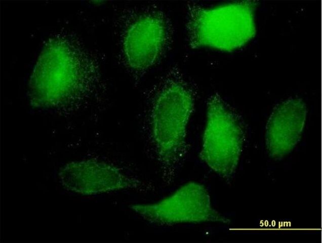 Anti-BCAP31 antibody produced in mouse