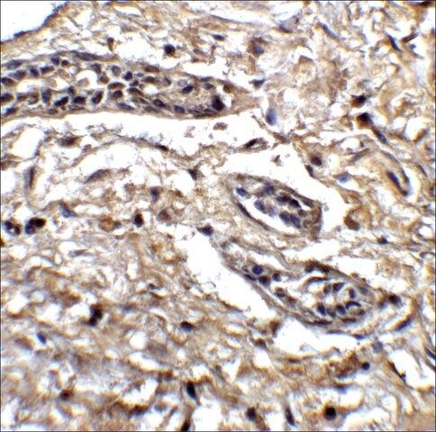 Anti-BCL9L antibody produced in rabbit