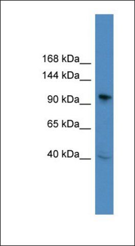 Anti-BCL11B antibody produced in rabbit