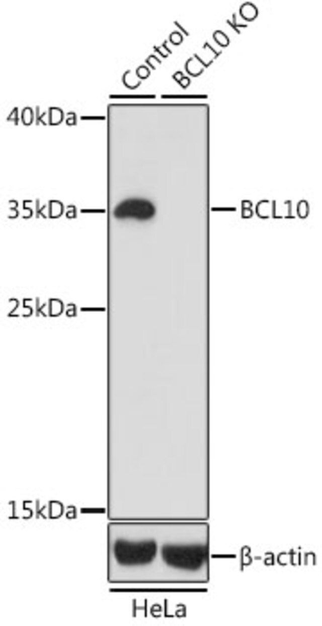 Anti-BCL10 antibody produced in rabbit