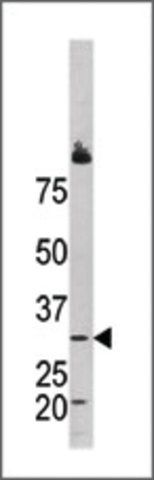 Anti-BCCIP (center)) antibody produced in rabbit