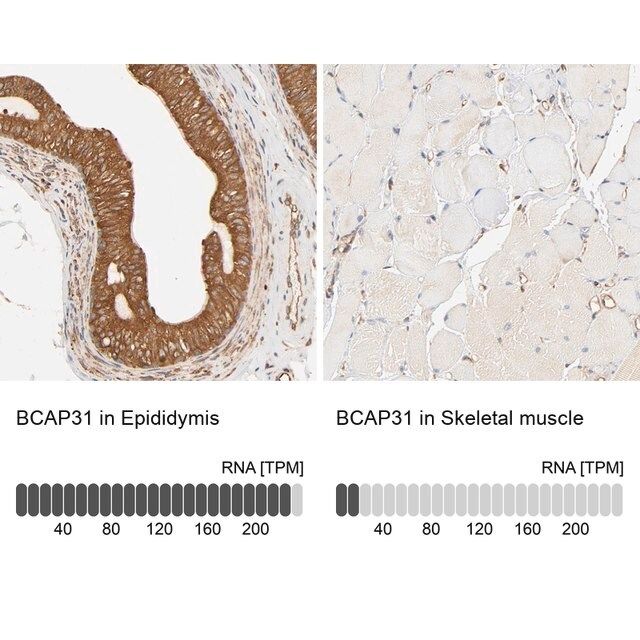 Anti-BCAP31 antibody produced in rabbit