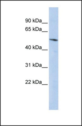 Anti-BCL6B antibody produced in rabbit