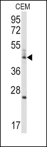 Anti-BCL2L13 (center) antibody produced in rabbit