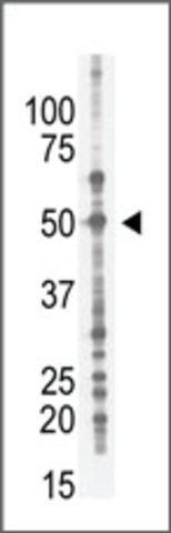 Anti-BDP1 (N-term) antibody produced in rabbit