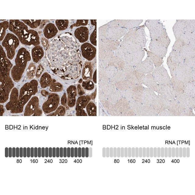 Anti-BDH2 antibody produced in rabbit