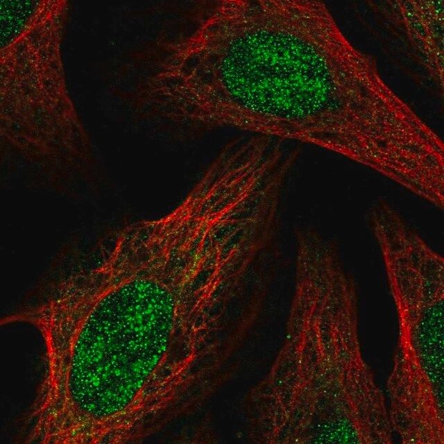 Anti-BCOR antibody produced in rabbit