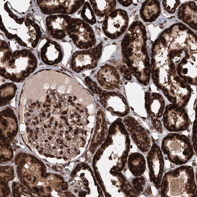 Anti-BCKDHA antibody produced in rabbit