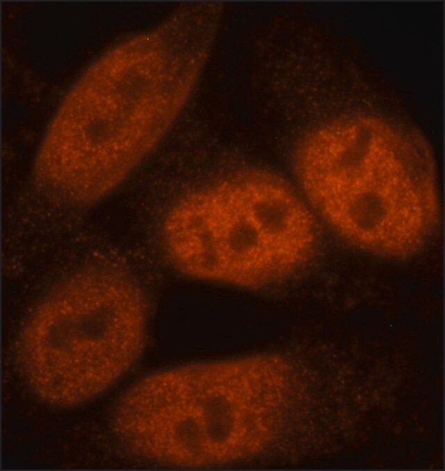 Anti-BCOR antibody, Mouse monoclonal