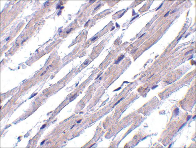 Anti-Bcl-rambo antibody produced in rabbit