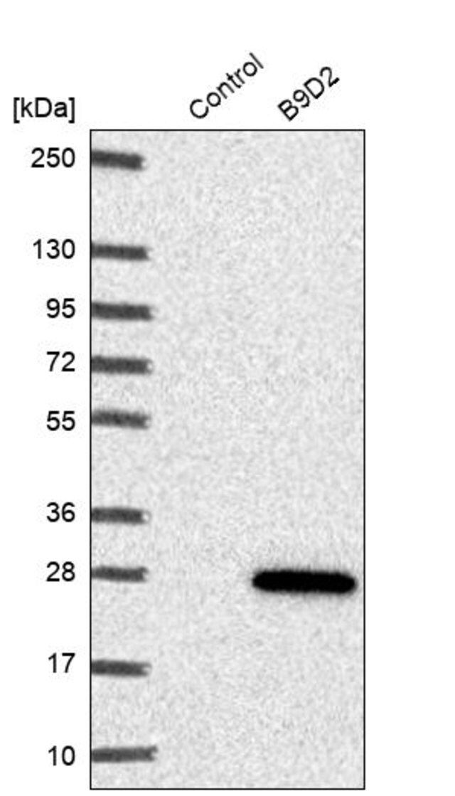 Anti-B9D2 antibody produced in rabbit