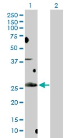 Anti-BCL7B antibody produced in rabbit