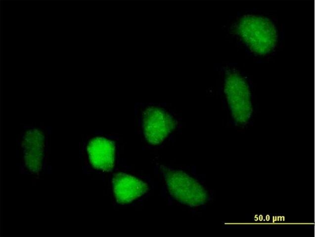 Anti-BCOR antibody produced in mouse