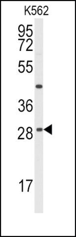 Anti-BCL2L10 (center) antibody produced in rabbit