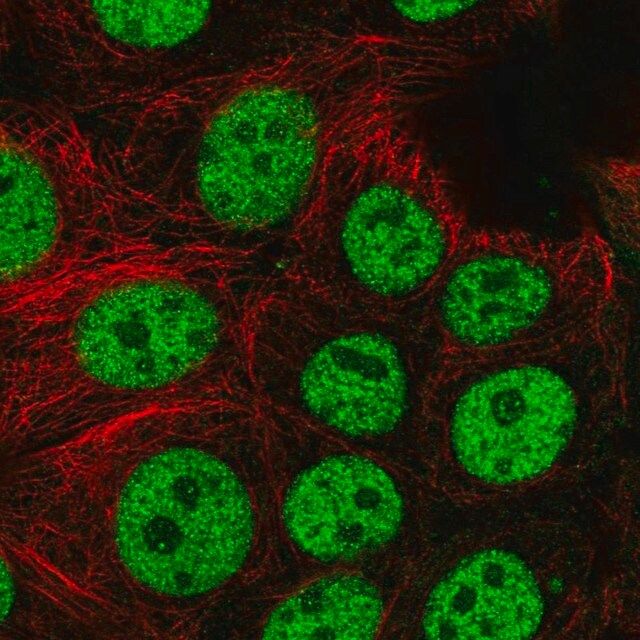 Anti-BCL7C antibody produced in rabbit