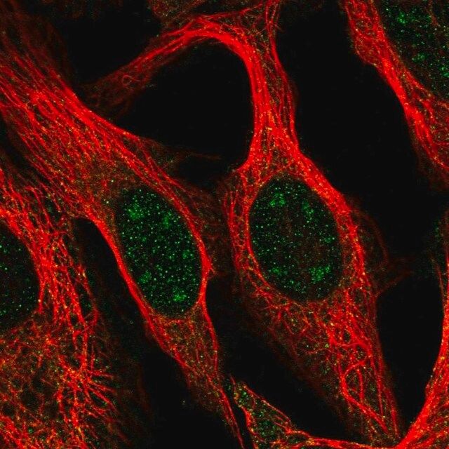 Anti-BCAS3 antibody produced in rabbit