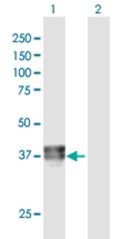 Anti-BCAT2 antibody produced in rabbit