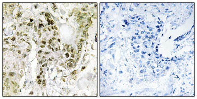 Anti-BCOR antibody produced in rabbit