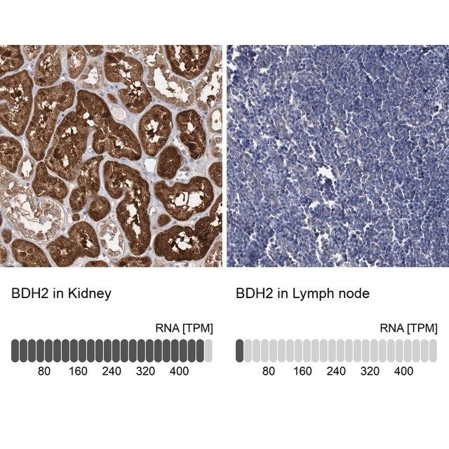 Anti-BDH2 antibody produced in rabbit