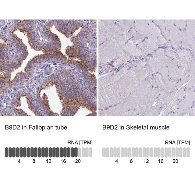 Anti-B9D2 antibody produced in rabbit