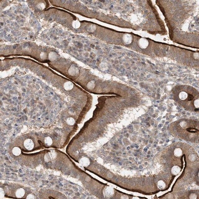 Anti-BCORL1 antibody produced in rabbit