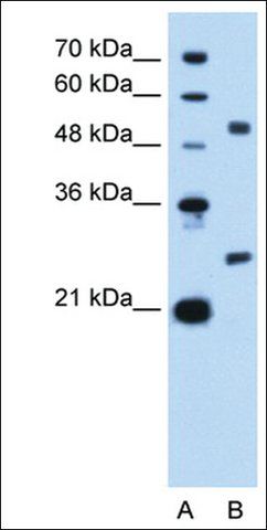 Anti-BCL2L1 antibody produced in rabbit